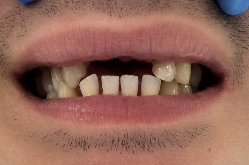 Before smile makeover